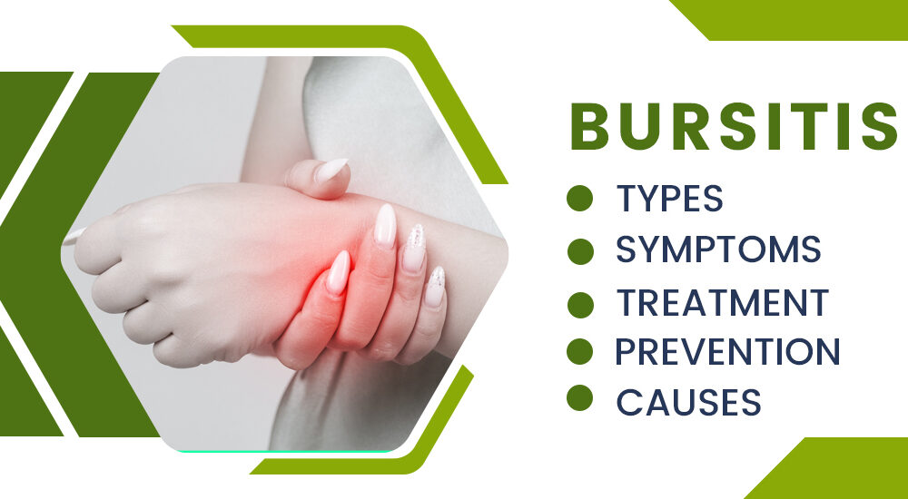 Understanding Bursitis: Causes, Symptoms, and Treatment Options