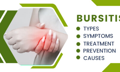 Understanding Bursitis: Causes, Symptoms, and Treatment Options
